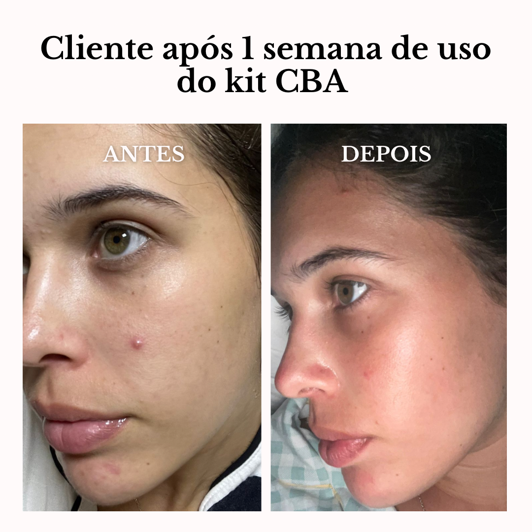 KIT CBA: SÉRUM RESTAURADOR + TRATAMENTO LÍQUIDO